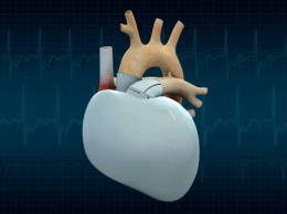 Идеальное искусственное сердце должно иметь вечную батарейку и не стучать