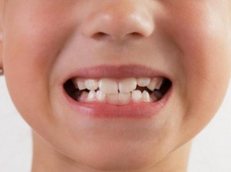 Плохие зубы? Виновата карма