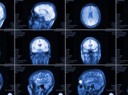 Ученые скрыли смерть человека с оживленным мозгом