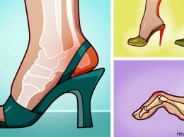 Если вы носите каблуки, вот 9 советов, на которых настаивают врачи!
