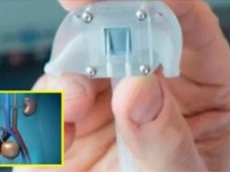 Создана первая в мире бионическая почка! Вот как она работает