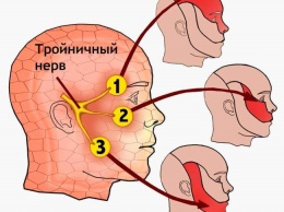 Забудете про гайморит и проблемы тройничного нерва - без лекарств!