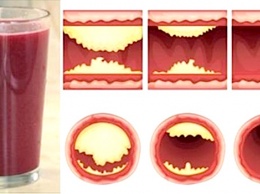 10 продуктов, которые помогут предотвратить блокировку артерий