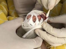 Младенцу грозит ампутация пальца из-за маминого волоса (фото)