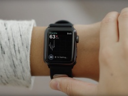 Следующее поколение Apple Watch могут оснастить датчиком ЭКГ