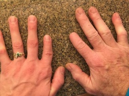 Отец отрезал себе палец ради ребенка