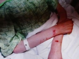 Кровавые раны на ногах и руках: мать заморила голодом падчерицу