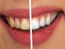 Уход за зубами: названы основные ошибки