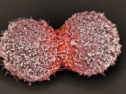 Найден механизм самоуничтожения раковых опухолей