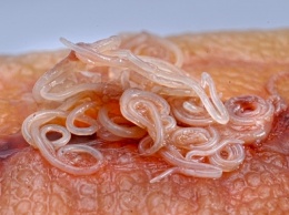 Херсонцы болеют паразитами из-за суши и шашлыка