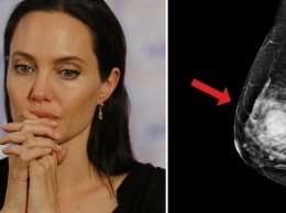Анджелина Джоли - худший из примеров! Вот кому на самом деле стоит провериться у генетика