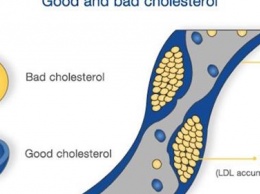 Как кокосовое масло влияет на уровень холестерина и процесс похудения