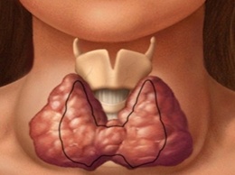 Щитовидная железа - это та, которая контролирует все тело! Вот как сохранить ее здоровье