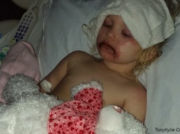 3-летняя девочка попала в больницу из-за популярной игрушки. Ее мать предупреждает