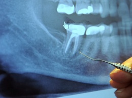 Очень странное открытие: 97% больных раком делали эту процедуру у стоматолога!