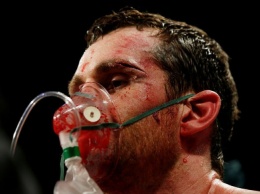 Британскому боксеру наложили более 40 швов после нокаута