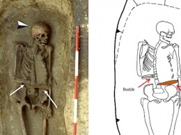 В Италии обнаружили средневекового "киборга"