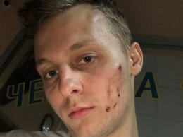 В ресторане Киева избили сына нардепа Шуфрича - пресс-служба политика