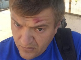 В Херсоне избили журналиста