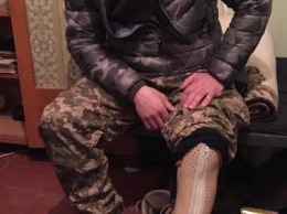 Боец ВСУ положил оторванную взрывом ногу в рюкзак и продолжал огонь по террористам, - ФОТО