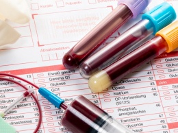 Анализ крови может определить срок жизни человека