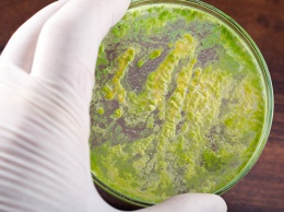 Медики предупредили об угрозе супербактерии, вызывающей бесплодие