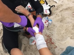 Акула атаковала детей на популярном курорте: фото