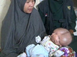 «Необъяснимое»:В Индонезии на свет появился ребенок с двумя головами