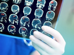 Ученые из России нашли возможный ключ к борьбе с эпилепсией