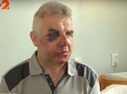 Неизвестные напали на семью головы Пуховского сельсовета (видео)