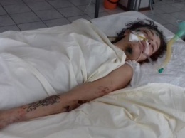 В Киевской области врачи просят опознать девушку, которая попала в ДТП