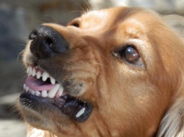 «Пес изуродовал лицо»: В Волгоградской области собака жестоко искусала ребенка