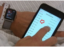 Apple Watch спас жизнь, уведомив пользователя о проблеме с сердцем