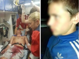 В Ивано-Франковске подросток нанес мужчине ножевые ранения за замечание