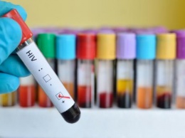 «Главная тайна 21 века»: ВИЧ - случайно появившееся заболевание или последствие теории заговора?