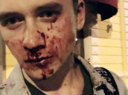 Пили вино, а не пиво: в Киеве избили парней из-за подозрений в гомосексуальности