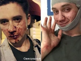 Швы на голове, сотрясение и ушибы: в Киеве избили двух парней «за ориентацию»