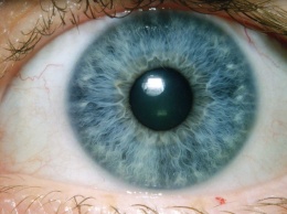 Google создали ИИ для диагностики глазных болезней