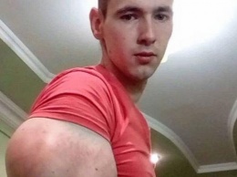 «Смотреть противно!»: Кирилл Терешин из-за синтоловых «рук-базук» страдает от прыщей на лице