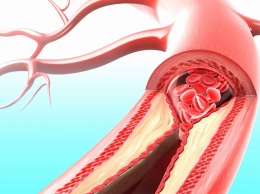 Приложение расскажет о заболеваниях сердца и сосудов без разрезов и уколов