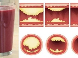 Этот вкусный сок будет расширять артерии и предотвращать сердечные заболевания!