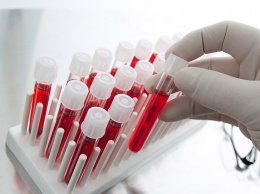 Новый анализ крови поможет узнать о риске рецидива рака