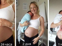 Мама и ее живот: как тело женщины в действительности выглядит после родов