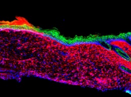 Новую кожу вырастили на открытой ране