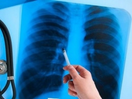 У воспитательницы детсада обнаружили туберкулез