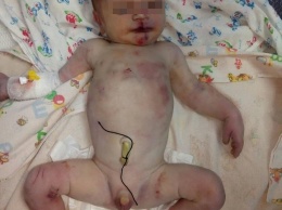 Жуть. Ребенок, подброшенный в «Окошко жизни» на Николаевщине, был с многочисленными синяками и черепно-мозговой травмой