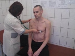 Москалькова: Состояние здоровья Сенцова стабильное, он находится под наблюдением врачей