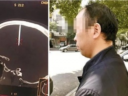 Житель Китая неделю ходил с пробитой гвоздем головой (фото)