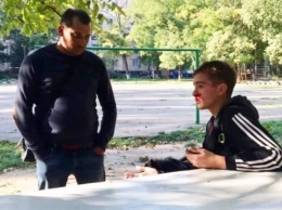 В Одессе пьяный мужчина потерял кошелек и от злости избил подростка
