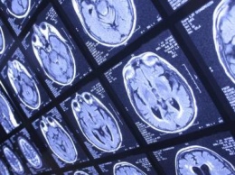 Ученые обнаружили соединение мозга с иммунной системой